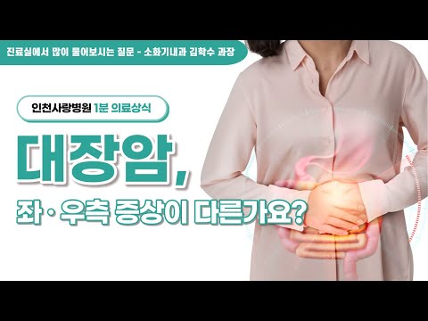 [1분 의료상식] 좌측·우측 대장암 증상이 다르다?